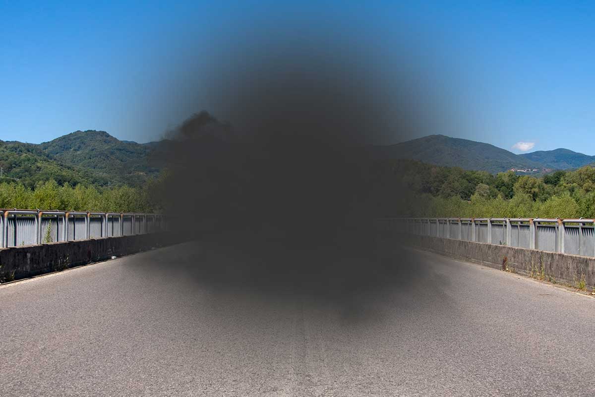 Medivision 16. Macular Degeneration